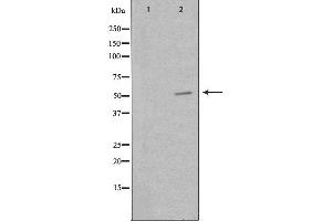 Western blot analysis of extracts from HepG2cells, using PKNOX2 antibody.
