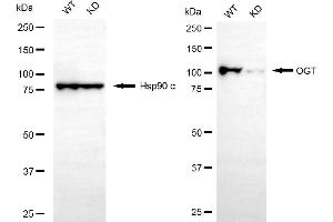 Western blotting analysis using OGT antibody (ABIN7799694).