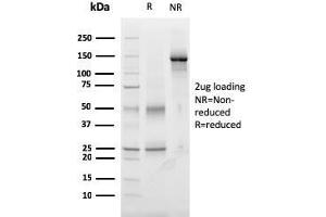 SDS-PAGE Analysis Purified Monospecific Mouse Monoclonal Antibody to TIGIT (TIGIT/3017). (TIGIT Antikörper  (AA 22-141))
