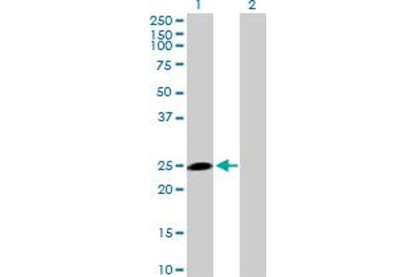 HECTD3 Antikörper  (AA 1-210)