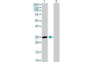 Western Blot analysis of HECTD3 expression in transfected 293T cell line by HECTD3 MaxPab polyclonal antibody.