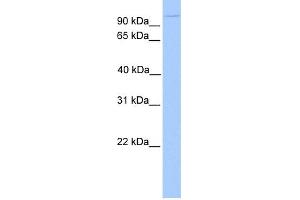 WB Suggested Anti-NUP98 Antibody Titration: 0. (NUP98 Antikörper  (N-Term))