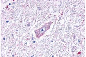 Anti-MRGPRD antibody  ABIN1049070 IHC staining of human brain, medulla. (MRGPRD Antikörper  (Cytoplasmic Domain))