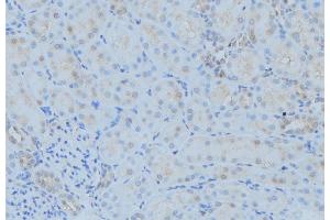 ABIN6279361 at 1/100 staining Mouse kidney tissue by IHC-P. (POLG Antikörper  (Internal Region))