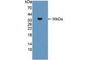 Western blot analysis of recombinant Human ERN1. (ERN1 Antikörper  (AA 571-832))
