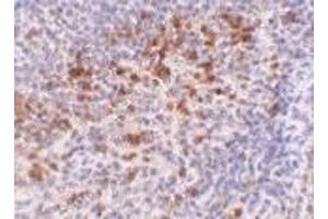 Immunohistochemistry of Catheli-cidin in human spleen tissue with Cathelicidin antibody at 5 μg/ml. (Cathelicidin Antikörper  (C-Term))