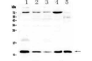 Western blot analysis of DYNLT1 using anti-DYNLT1 antibody .