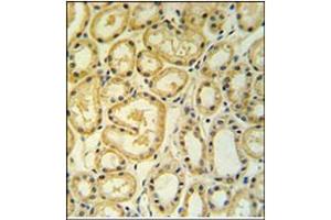 Immunohistochemistry analysis in Formalin Fixed, Paraffin Embedded Human lung tissue using RT25 antibody (C-term) followed by peroxidase conjugation of the secondary antibody and DAB staining. (MRPS25 Antikörper  (C-Term))