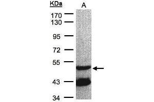 WB Image Sample(30 μg of whole cell lysate) A:Raji, 7. (GNAL Antikörper  (Center))