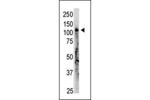 The anti-OAS3 C-term Antibody (ABIN390166 and ABIN2840662) is used in Western blot to detect OAS3 in  lysate.