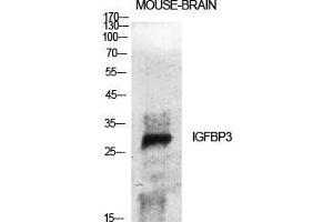 Western Blot (WB) analysis of specific cells using IGFBP3 Polyclonal Antibody. (IGFBP3 Antikörper  (Ser53))