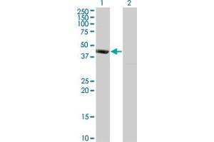 Western Blot analysis of PSMD6 expression in transfected 293T cell line by PSMD6 monoclonal antibody (M01), clone 1C1. (PSMD6 Antikörper  (AA 292-389))