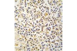 Image no. 2 for anti-Aldehyde Dehydrogenase 1 Family, Member A3 (ALDH1A3) (N-Term) antibody (ABIN360200) (ALDH1A3 Antikörper  (N-Term))