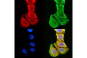 ABIN6259425 and ABIN6276230 staining Hela cells(30 min of UV treatment) by IF/ICC. (TMEM145 Antikörper  (N-Term))