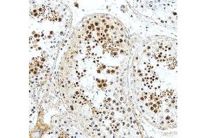 IHC analysis of DAZAP1 using anti-DAZAP1 antibody (ABIN6719309). (DAZAP1 Antikörper  (AA 1-189))