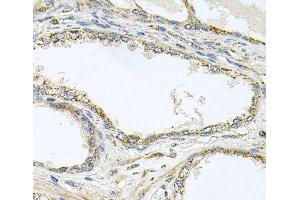 Immunohistochemistry of paraffin-embedded Human prostate using TNFRSF10A Polyclonal Antibody at dilution of 1:100 (40x lens). (TNFRSF10A Antikörper)
