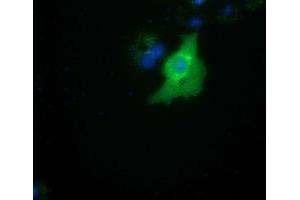 Anti-SMAD2 mouse monoclonal antibody (ABIN2453655) immunofluorescent staining of COS7 cells transiently transfected by pCMV6-ENTRY SMAD2 (RC204604). (SMAD2 Antikörper)