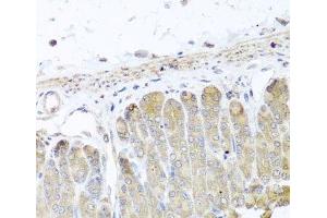 Immunohistochemistry of paraffin-embedded Mouse stomach using IRS2 Polyclonal Antibody at dilution of 1:100 (40x lens). (IRS2 Antikörper)