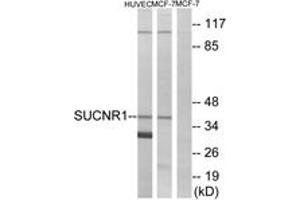 Western blot analysis of extracts from HuvEc/MCF-7 cells, using SUCNR1 Antibody. (SUCNR1 Antikörper  (AA 100-149))