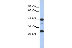 WB Suggested Anti-TMPO  Antibody Titration: 0. (Thymopoietin Antikörper  (N-Term))