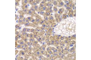 Immunohistochemistry of paraffin-embedded rat liver using FASTK antibody (ABIN5974251) at dilution of 1/100 (40x lens).