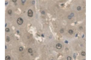Detection of ANTXR2 in Human Liver Tissue using Polyclonal Antibody to Anthrax Toxin Receptor 2 (ANTXR2) (ANTXR2 Antikörper  (AA 34-318))