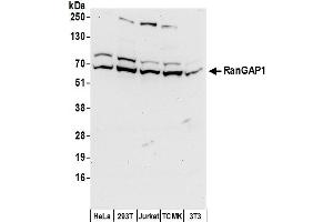 Western Blotting (WB) image for anti-Ran GTPase Activating Protein 1 (RANGAP1) (AA 100-150) antibody (ABIN7454802)