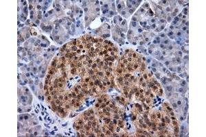 Immunohistochemical staining of paraffin-embedded Kidney tissue using anti-RC219453 mouse monoclonal antibody.