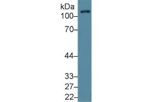 Western Blotting (WB) image for anti-PTK2 Protein tyrosine Kinase 2 (PTK2) (AA 798-1041) antibody (ABIN7439699)