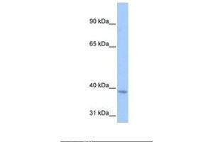 Image no. 1 for anti-NOP2/Sun Domain Family, Member 3 (NSUN3) (AA 239-288) antibody (ABIN6738516) (NSUN3 Antikörper  (AA 239-288))