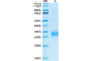 Human ALK-1/ACVRL1 on Tris-Bis PAGE under reduced condition. (ACVRL1 Protein (AA 22-118) (His tag))
