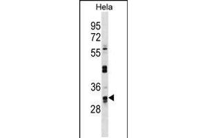 Western blot analysis in Hela cell line lysates (35ug/lane). (UTP11L Antikörper  (C-Term))