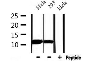 Western blot analysis of extracts from Hela and 293, using MIF Antibody. (MIF Antikörper  (C-Term))