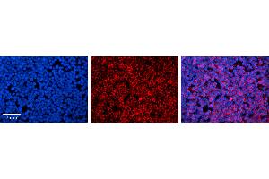 Rabbit Anti-STAT1 Antibody Catalog Number: ARP33373_P050 Formalin Fixed Paraffin Embedded Tissue: Human Lymph Node Tissue Observed Staining: Cytoplasm Primary Antibody Concentration: 1:100 Other Working Concentrations: N/A Secondary Antibody: Donkey anti-Rabbit-Cy3 Secondary Antibody Concentration: 1:200 Magnification: 20X Exposure Time: 0.