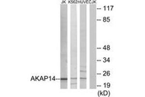 Western Blotting (WB) image for anti-A Kinase (PRKA) Anchor Protein 14 (AKAP14) (AA 1-50) antibody (ABIN2889659) (AKAP14 Antikörper  (AA 1-50))