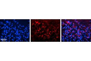 Immunohistochemistry (IHC) image for anti-Solute Carrier Family 25 (Mitochondrial Carrier, Adenine Nucleotide Translocator), Member 4 (SLC25A4) (N-Term) antibody (ABIN2781568)