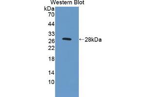 Western blot analysis of the recombinant protein. (IL4 Receptor Antikörper  (AA 26-233))