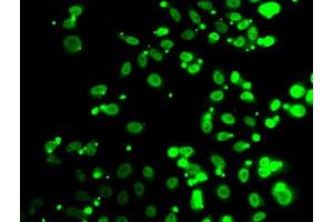 Immunofluorescence analysis of A549 cells using FIP1L1 antibody (ABIN5974293). (FIP1L1 Antikörper)