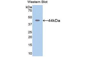 Western Blotting (WB) image for anti-Matrix Metallopeptidase 8 (Neutrophil Collagenase) (MMP8) (AA 101-467) antibody (ABIN1078309) (MMP8 Antikörper  (AA 101-467))
