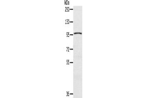 Western Blotting (WB) image for anti-CDKN1A Interacting Zinc Finger Protein 1 (CIZ1) antibody (ABIN2435266)
