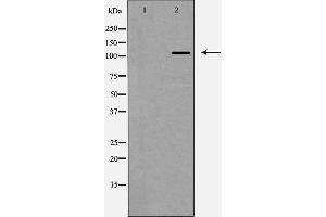 Western blot analysis of Integrin αV expression in HeLa cells,The lane on the left is treated with the antigen-specific peptide. (CD51 Antikörper  (Internal Region))