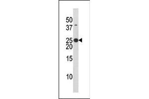 The anti-Phospho-Bad- Pab (ABIN389519 and ABIN2839570) is used in Western blot to detect Phospho-Bad- in HL60 tissue lysate (BAD Antikörper  (pSer134))