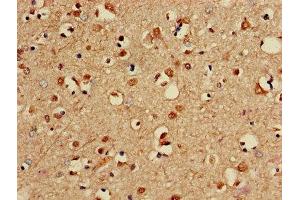 Immunohistochemistry (IHC) image for anti-Protein Phosphatase 2, Catalytic Subunit, beta Isozyme (PPP2CB) (AA 1-309), (Catalytic Subunit beta) antibody (ABIN7169270)