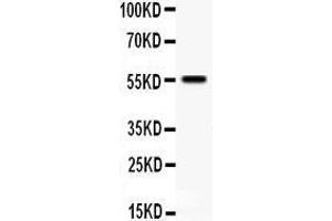 Anti- TFPI antibody, Western blotting All lanes: Anti TFPI  at 0.