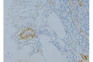 ABIN6275032 at 1/100 staining Human uterus tissue by IHC-P. (C1S Antikörper  (C-Term))