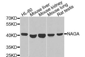 Western blot analysis of extracts of various cell lines, using NAGA antibody.
