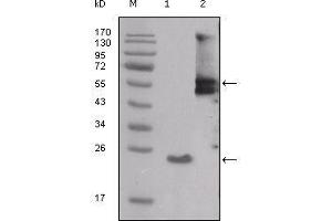 Western blot analysis using SRC mouse mAb against truncated SRC-His recombinant protein (1) and PMA treated THP-1 cell lysate (2). (Src Antikörper  (AA 10-193))
