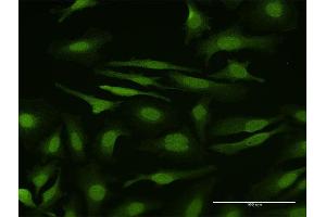 Immunofluorescence of purified MaxPab antibody to SMAD6 on HeLa cell.