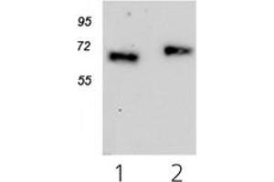 Western Blotting (WB) image for anti-Cytokine Receptor-Like Factor 2 (CRLF2) antibody (ABIN1106837)