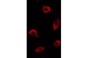 ABIN6274467 staining HT29 cells by IF/ICC. (PMEPA1 Antikörper  (Internal Region))